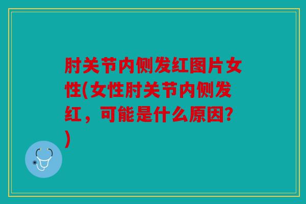 肘关节内侧发红图片女性(女性肘关节内侧发红，可能是什么原因？)