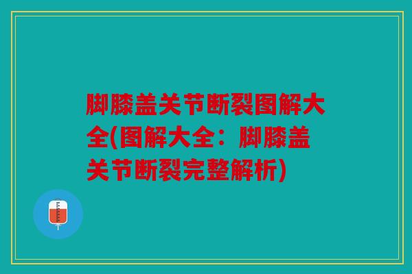 脚膝盖关节断裂图解大全(图解大全:脚膝盖关节断裂完整解析) 脚膝盖关节断裂图解大全(图解大全:脚膝盖关节断裂完整解析)