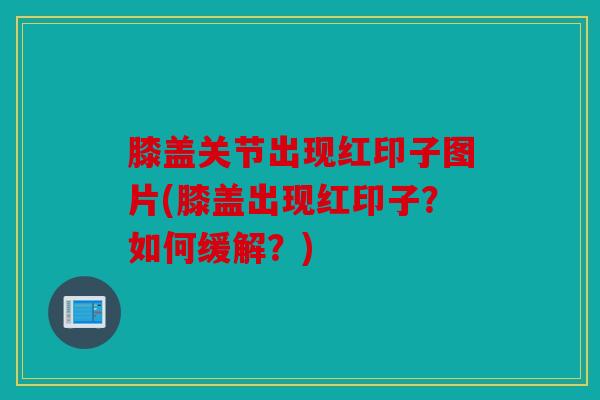 膝盖关节出现红印子图片(膝盖出现红印子?如何缓解?) 膝盖关节出现红印子图片(膝盖出现红印子?如何缓解?)