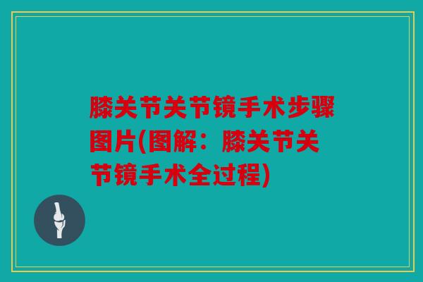 膝关节关节镜手术步骤图片(图解：膝关节关节镜手术全过程)