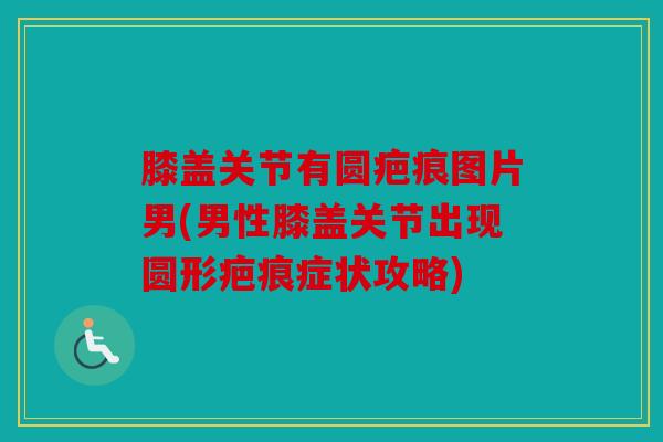 膝盖关节有圆疤痕图片男(男性膝盖关节出现圆形疤痕症状攻略) 膝盖关节有圆疤痕图片男(男性膝盖关节出现圆形疤痕症状攻略)