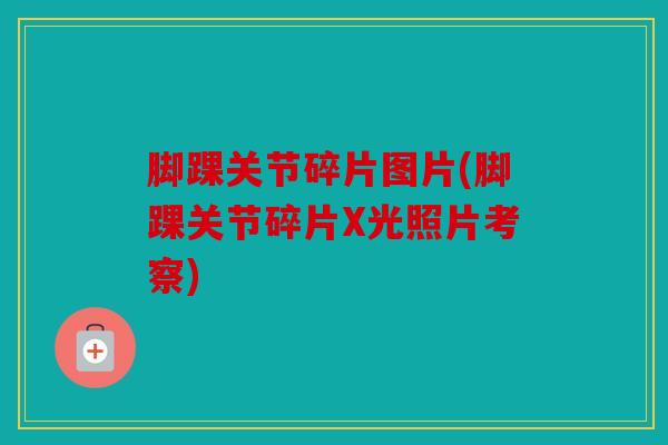脚踝关节碎片图片(脚踝关节碎片X光照片考察) 脚踝关节碎片图片(脚踝关节碎片X光照片考察)