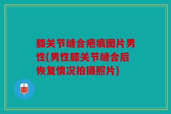 膝关节缝合疤痕图片男性(男性膝关节缝合后恢复情况拍摄照片)