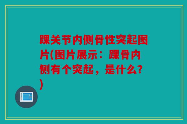 踝关节内侧骨性突起图片(图片展示:踝骨内侧有个突起,是什么?) 踝关节内侧骨性突起图片(图片展示:踝骨内侧有个突起,是什么?)