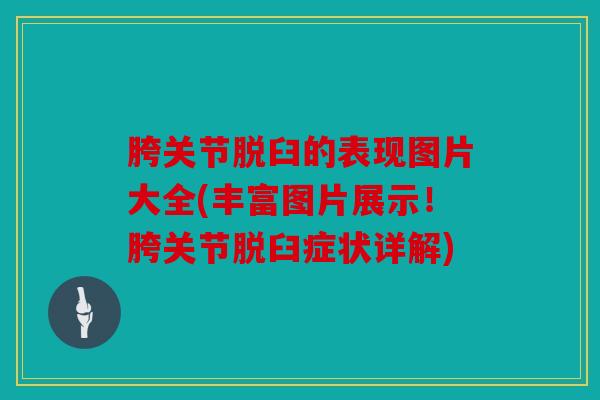 胯关节脱臼的表现图片大全(丰富图片展示!胯关节脱臼症状详解) 胯关节脱臼的表现图片大全(丰富图片展示!胯关节脱臼症状详解)