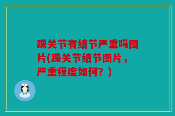 踝关节有结节严重吗图片(踝关节结节图片,严重程度如何?) 踝关节有结节严重吗图片(踝关节结节图片,严重程度如何?)