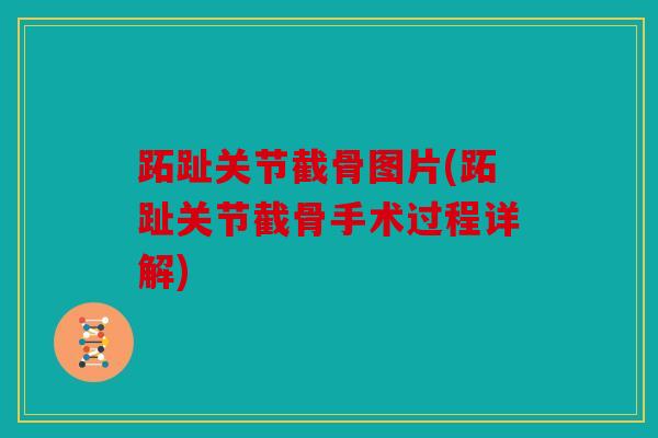 跖趾关节截骨图片(跖趾关节截骨手术过程详解)