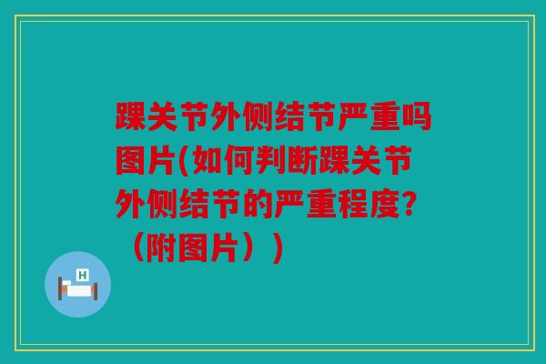 踝关节外侧结节严重吗图片(如何判断踝关节外侧结节的严重程度?(附图片)) 踝关节外侧结节严重吗图片(如何判断踝关节外侧结节的严重程度?(附图片))
