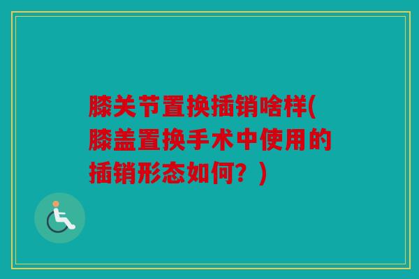 膝关节置换插销啥样(膝盖置换手术中使用的插销形态如何?) 膝关节置换插销啥样(膝盖置换手术中使用的插销形态如何?)