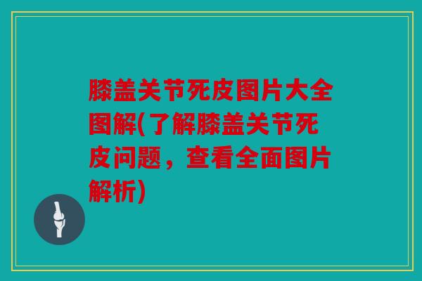 膝盖关节死皮图片大全图解(了解膝盖关节死皮问题,查看全面图片解析) 膝盖关节死皮图片大全图解(了解膝盖关节死皮问题,查看全面图片解析)