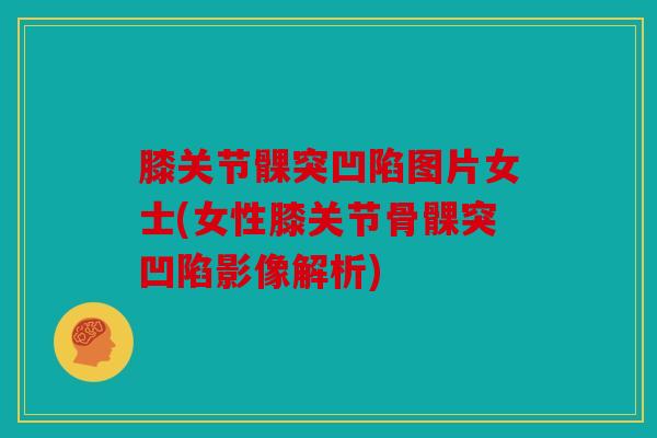 膝关节髁突凹陷图片女士(女性膝关节骨髁突凹陷影像解析)